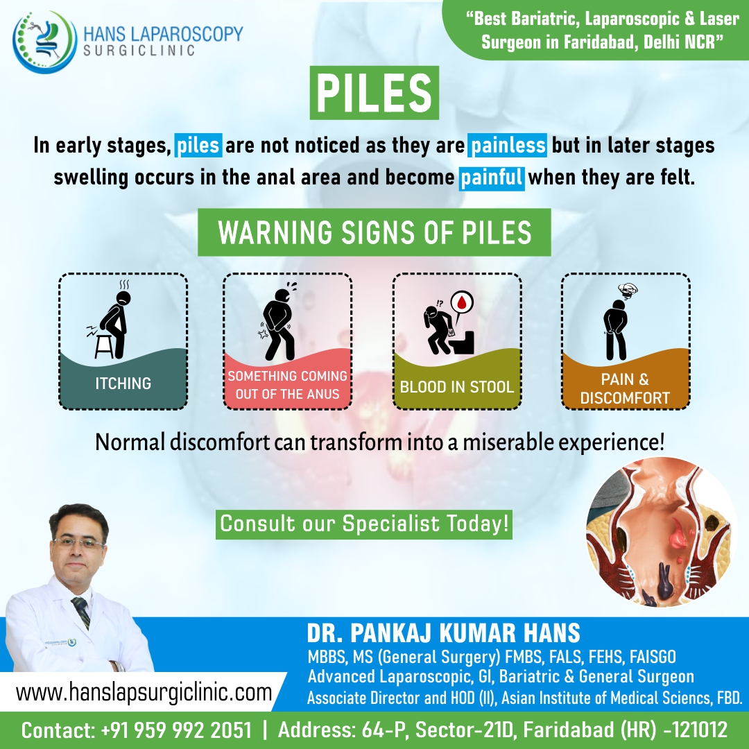 everything-you-need-to-know-about-piles-instant-approval-guest